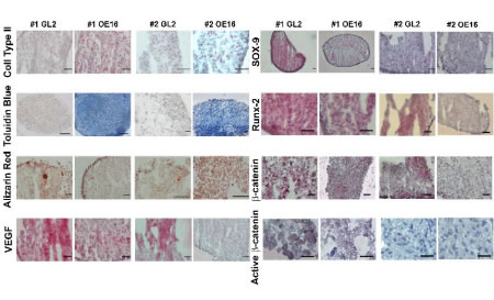 Figure 1 - Effects of MMP-13 KD on ECM remodelling, mineralization and VEGF expression and regulators of chondrocyte differentiation in micromass cultures.